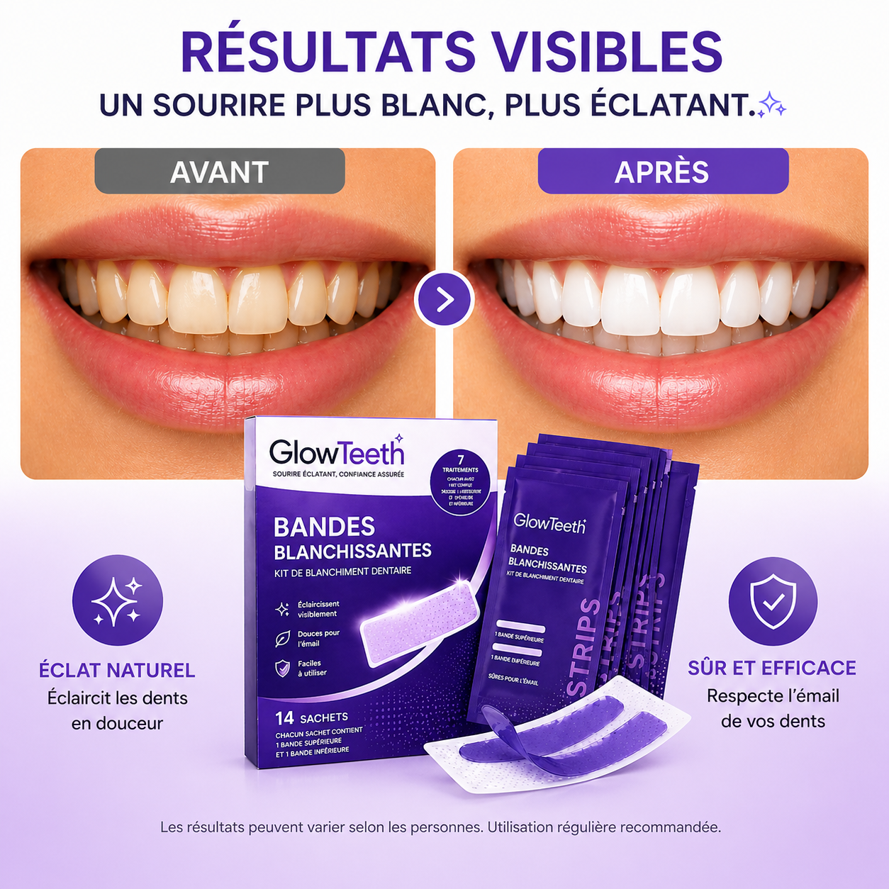 GlowTeeth | Kit Bandes Blanchissantes